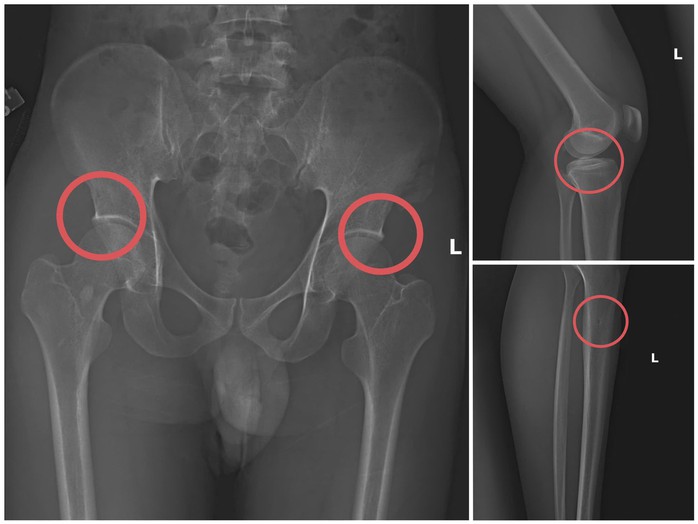 Cựu cán bộ y tế cầm đầu đường dây chuyên dùng búa đập vỡ xương, chiếm đoạt tiền bảo hiểm- Ảnh 2. Cựu cán bộ y tế cầm đầu đường dây chuyên dùng búa đập vỡ xương, chiếm đoạt tiền bảo hiểm- Ảnh 2.