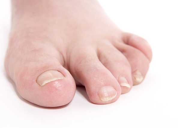 Nếu bàn chân bạn xuất hiện 5 dấu hiệu này, có thể là cảnh báo bệnh nghiêm trọng: Hãy chú ý kỹ hơn khi rửa chân mỗi ngày- Ảnh 4.