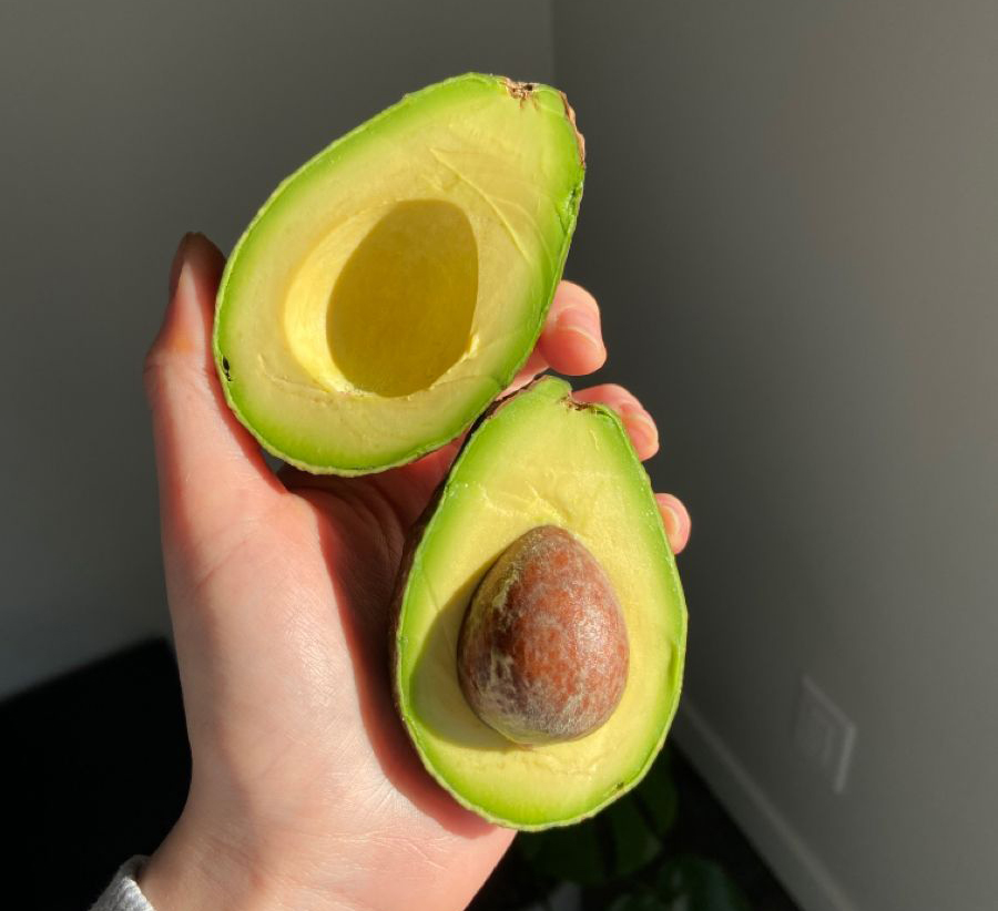 "Lạ đời" người đàn ông ăn loại quả cực béo để "vét" mỡ trong máu, 3 tháng sau bác sĩ cũng bất ngờ - Ảnh 2.