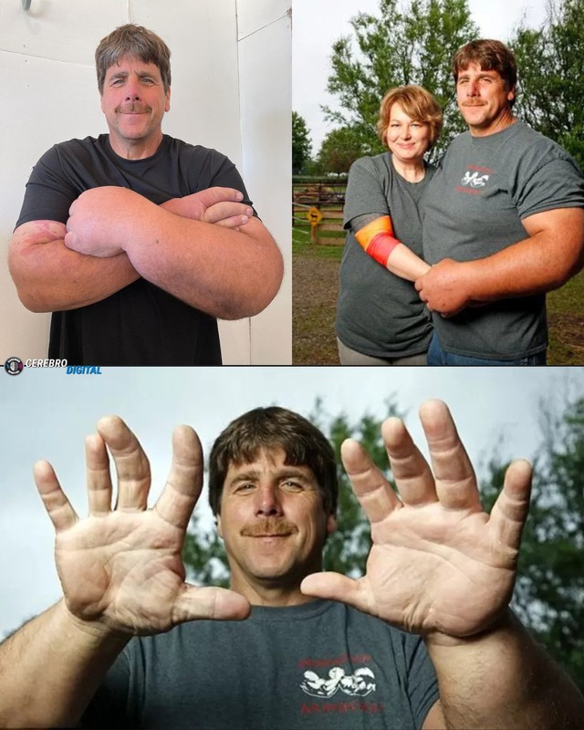 Người đàn ông sở hữu bàn tay to bất thường, sự thật phía sau khiến tất cả kinh ngạc- Ảnh 1.