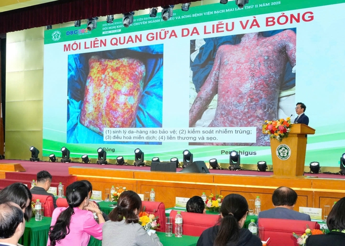 Mưa lũ miền Trung: Cảnh báo nguy cơ bùng phát bệnh ngoài da- Ảnh 2. Mưa lũ miền Trung: Cảnh báo nguy cơ bùng phát bệnh ngoài da- Ảnh 2.