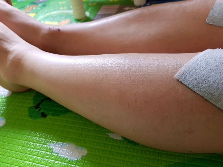 4 bất thường ở chân là dấu hiệu ung thư phổi dù nói ra có nhiều người CHẲNG CHỊU TIN! - Ảnh 1.