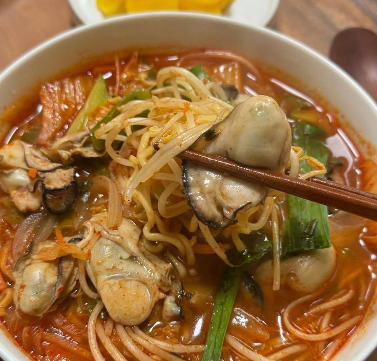 Cô gái sụt 15kg, dạ dày bị liệt vì món mì hot trend bao năm giới trẻ Việt vẫn "mê như điếu đổ" - Ảnh 2.