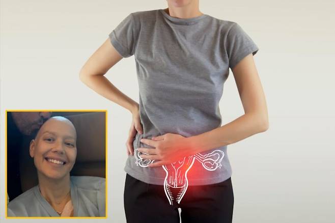 Cuộc chiến sống còn của người phụ nữ 50 tuổi sau khi phẫu thuật loại bỏ 7 cơ quan vì ung thư buồng trứng giai đoạn 4- Ảnh 1. Cuộc chiến sống còn của người phụ nữ 50 tuổi sau khi phẫu thuật loại bỏ 7 cơ quan vì ung thư buồng trứng giai đoạn 4- Ảnh 1.