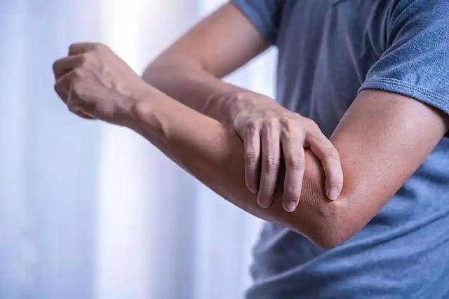 Bất kể nam hay nữ, nếu gặp phải 4 triệu chứng này ở cánh tay, rất có thể bạn bị ung thư: Dấu hiệu thứ 3 bị bỏ qua nhiều nhất- Ảnh 5. Bất kể nam hay nữ, nếu gặp phải 4 triệu chứng này ở cánh tay, rất có thể bạn bị ung thư: Dấu hiệu thứ 3 bị bỏ qua nhiều nhất- Ảnh 5.