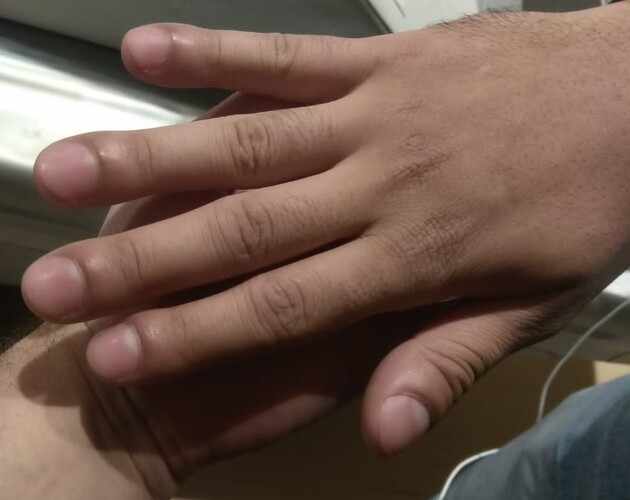 Rõ ràng bị đau vai nhưng bác sĩ lại báo mắc ung thư phổi, người đàn ông gào khóc: “Sai ở đâu?” - Ảnh 3.