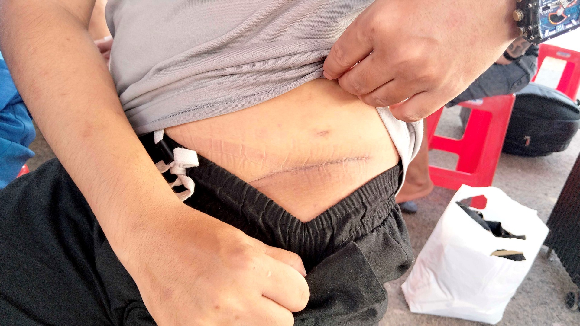 Nam thanh niên bị cưỡng ép cắt thận khi làm việc nhẹ lương cao tại Campuchia - Ảnh 2. Nam thanh niên bị cưỡng ép cắt thận khi làm việc nhẹ lương cao tại Campuchia - Ảnh 2.