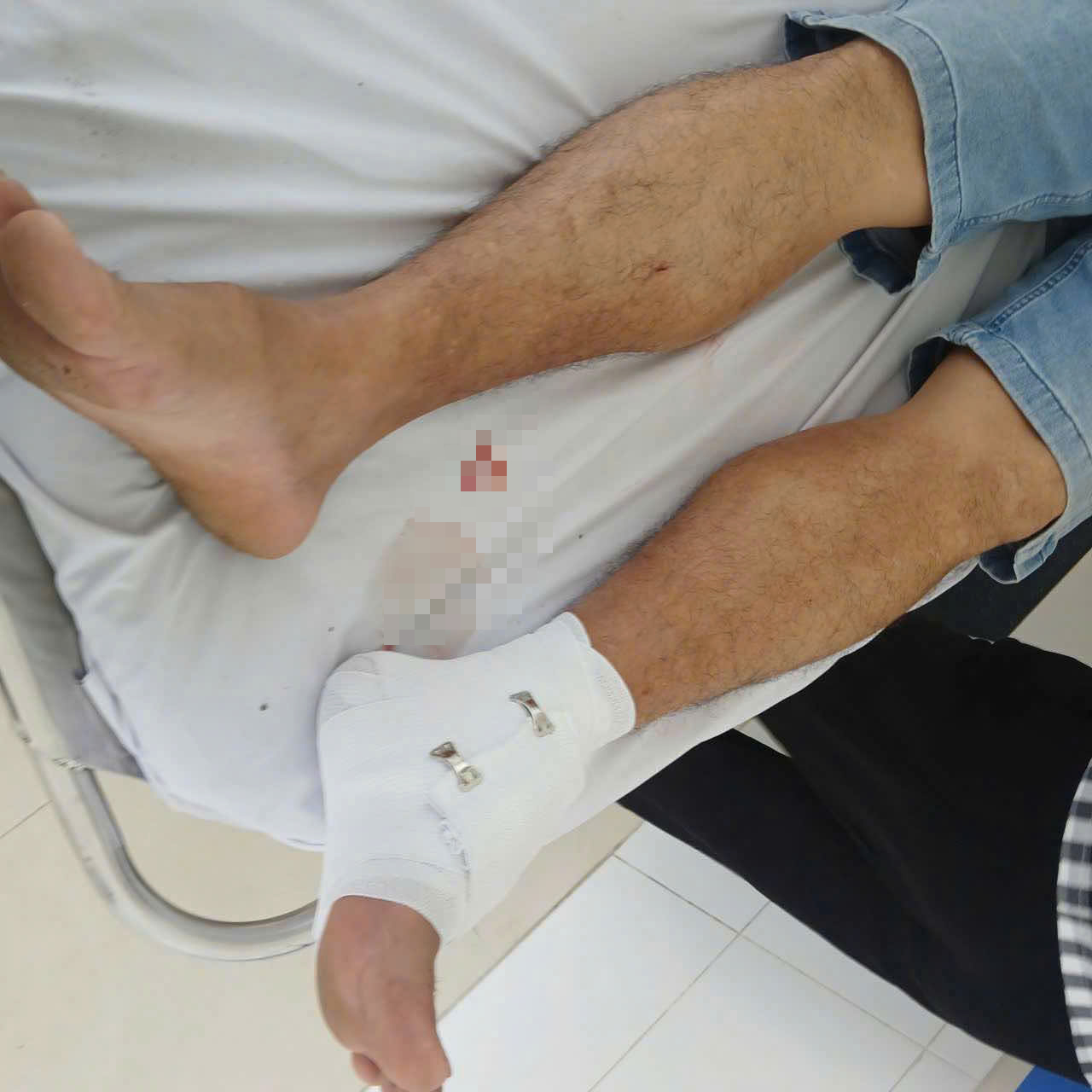 Vụ cá sấu cắn thầy giáo ở Tây Ninh và án Phạt 315 triệu đồng cho người nuôi - Ảnh 2. Vụ cá sấu cắn thầy giáo ở Tây Ninh và án Phạt 315 triệu đồng cho người nuôi - Ảnh 2.