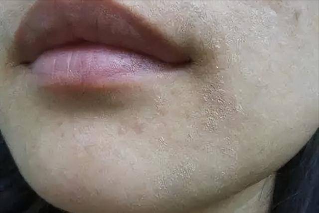 Uṓng nước buổi sáng mang lại 6 lợi ích sức khỏe bất ngờ trong 3 tháng - Ảnh 5.