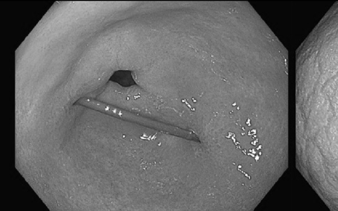 Người phụ nữ 35 tuổi tử vong vì uống nước theo cách "lạ đời" - Ảnh 2.