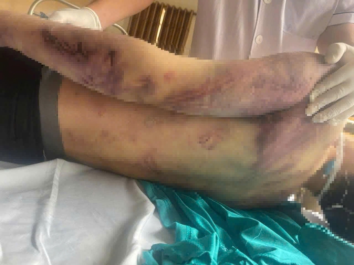 Tạm đình chỉ Trung tâm Công tác xã hội Hải Hà điều tra vụ học viên tử vong - Ảnh 1.