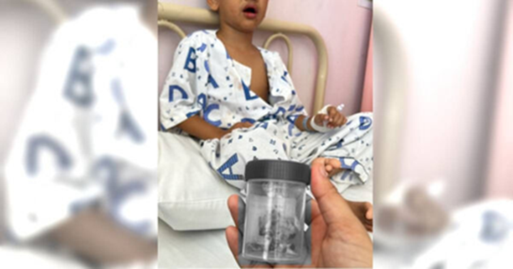 Bé trai 12 tuổi mất 12 chiếc răng vì thói quen vệ sinh răng miệng kém - Ảnh 1.