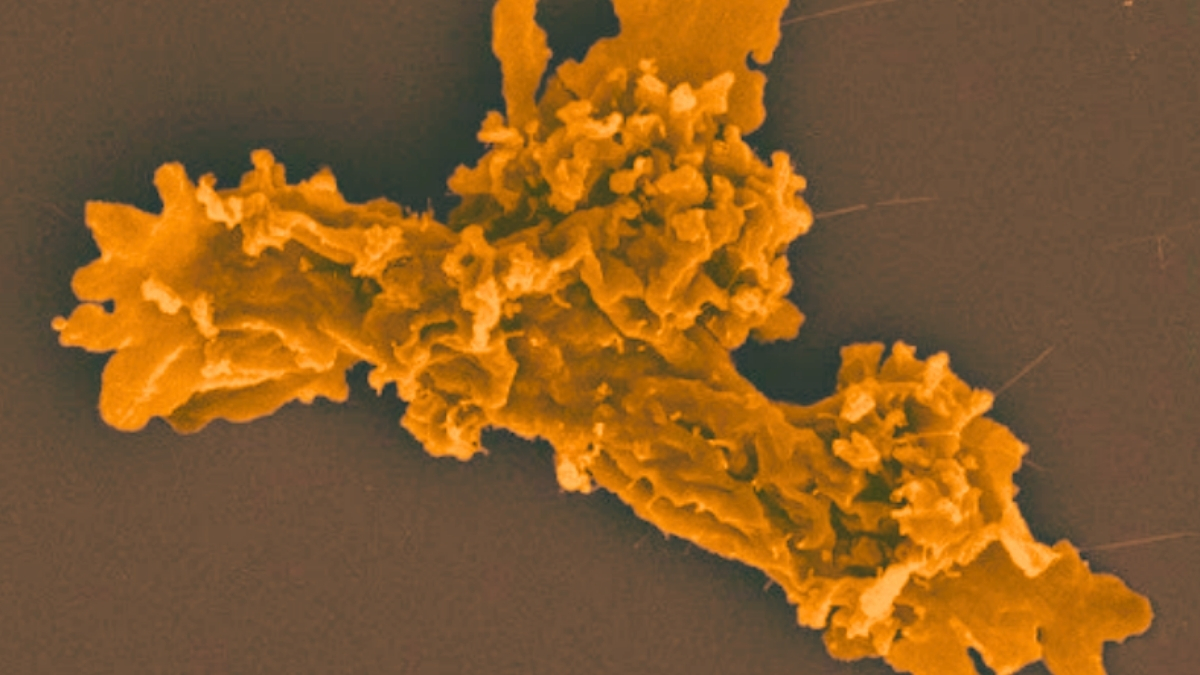 Phát hiện amip mới Incendiamoeba cascadensis có khả năng chịu nhiệt cao kỷ lục - Ảnh 1. Phát hiện amip mới Incendiamoeba cascadensis có khả năng chịu nhiệt cao kỷ lục - Ảnh 1.