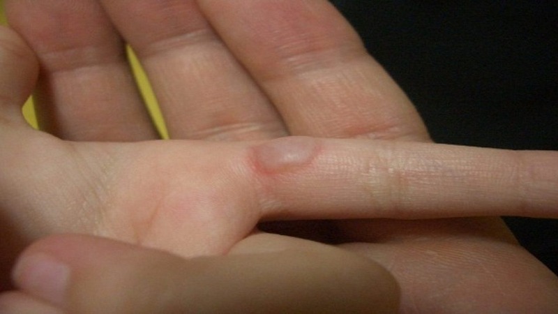 Rủi ro khi dùng ấm siêu tốc bạn cần biết để bảo vệ sức khỏe gia đình - Ảnh 3. Rủi ro khi dùng ấm siêu tốc bạn cần biết để bảo vệ sức khỏe gia đình - Ảnh 3.