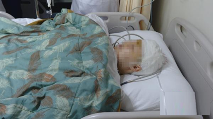 Bà Lý 55 tuổi hôn mê vì viêm màng não sau khi ăn thịt đông lạnh - Ảnh 1. Bà Lý 55 tuổi hôn mê vì viêm màng não sau khi ăn thịt đông lạnh - Ảnh 1.