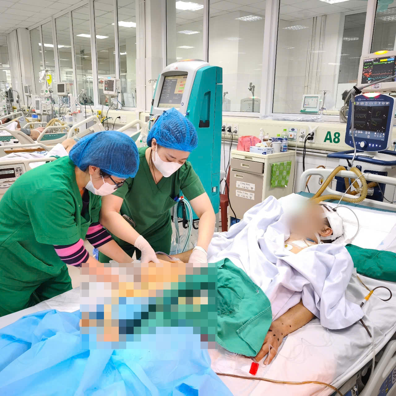 22 lít chế phẩm máu và 26 giờ căng thẳng của các y bác sĩ để giành lại sự sống cho một con người- Ảnh 3. 22 lít chế phẩm máu và 26 giờ căng thẳng của các y bác sĩ để giành lại sự sống cho một con người- Ảnh 3.