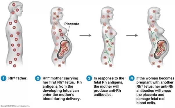Người đàn ông hiến máu nhiều nhất lịch sử thế giới: 1.173 lần, cứu sống 2,4 triệu người, được mệnh danh là "cánh tay vàng" trong làng hiến máu- Ảnh 2.