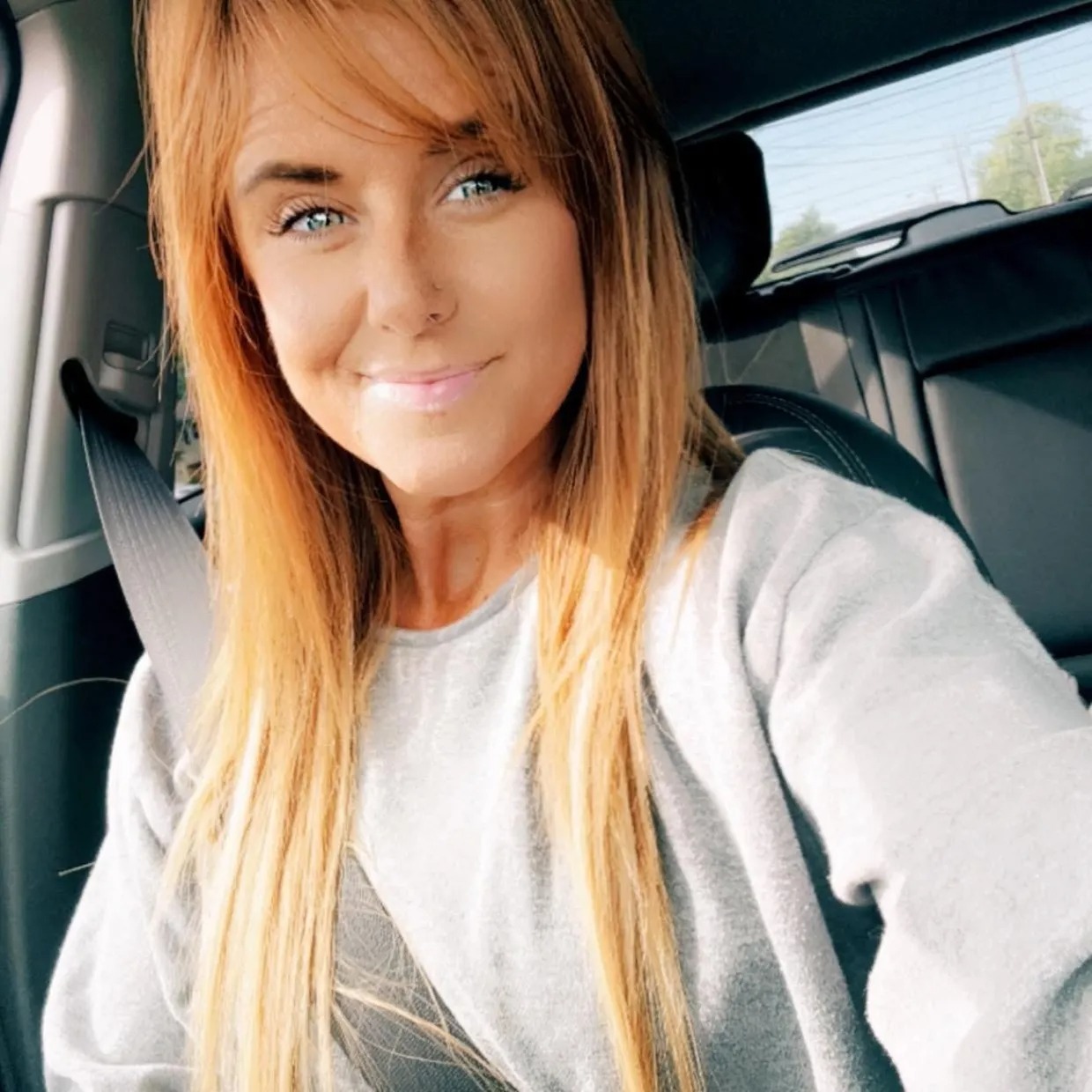 Cô gái đổ gục sau khi tập động tác ai cũng làm trong phòng gym, tỉnh dậy thấy "tay không còn là của mình"- Ảnh 1.