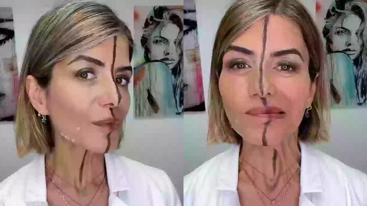 Nữ bác sĩ tiêm botox nửa khuôn mặt để chứng minh tác hại của cách làm đẹp này- Ảnh 1. Nữ bác sĩ tiêm botox nửa khuôn mặt để chứng minh tác hại của cách làm đẹp này- Ảnh 1.