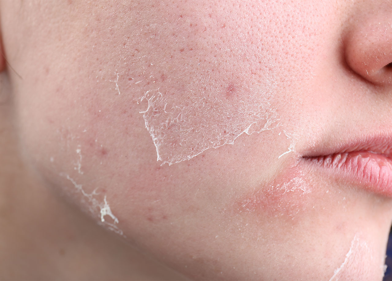 Sau tuổi 40 phụ nữ muốn giữ nhiều collagen trên mặt nhớ tránh 3 thói quen "độc hại", nếu không sẽ lão hóa nhanh, nếp nhăn nhiều- Ảnh 3.