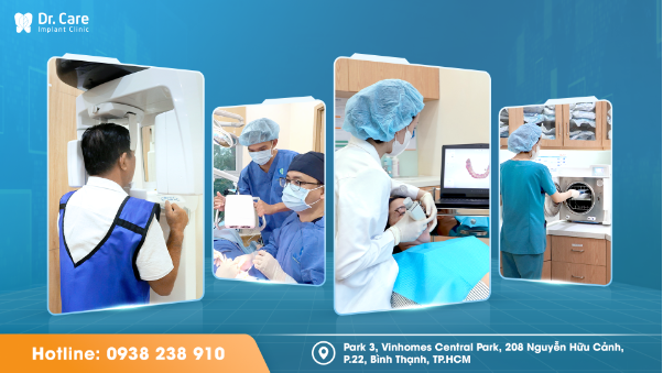 Làm răng tuổi 58, có nên đánh đổi sức khỏe chọn giá rẻ?- Ảnh 3. Làm răng tuổi 58, có nên đánh đổi sức khỏe chọn giá rẻ?- Ảnh 3.