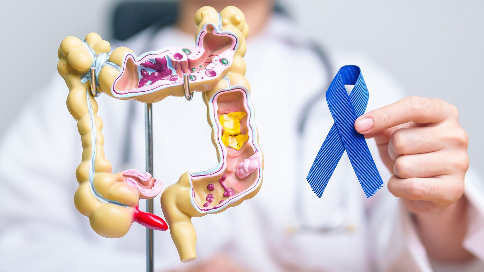 Ung thư không tấn công bừa bãi mà đặc biệt "để mắt" đến 3 nhóm người sau- Ảnh 1. Ung thư không tấn công bừa bãi mà đặc biệt "để mắt" đến 3 nhóm người sau- Ảnh 1.