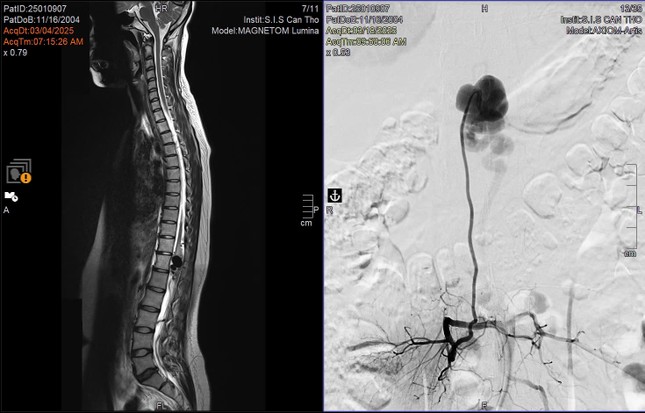 Cô gái đi khám từ lúc 2 tuổi, 19 năm sau mới tìm ra bệnh hiếm gặp- Ảnh 1.