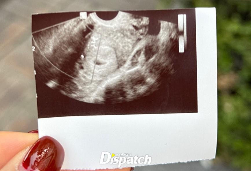 Dispatch vào cuộc vụ Son Heung-min bị tống tiền, tiết lộ gây sốc: Bạn gái cũ có thai nhưng không biết là con của ai- Ảnh 2. Dispatch vào cuộc vụ Son Heung-min bị tống tiền, tiết lộ gây sốc: Bạn gái cũ có thai nhưng không biết là con của ai- Ảnh 2.