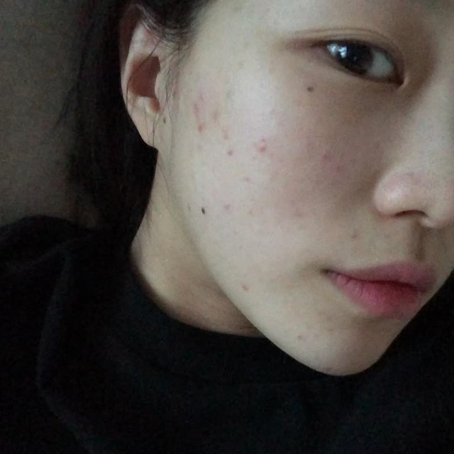 7 dấu hiệu cho thấy cơ thể tích tụ quá nhiều độc tố, không nhanh tay thải độc sẽ bùng phát đủ thứ bệnh- Ảnh 1.