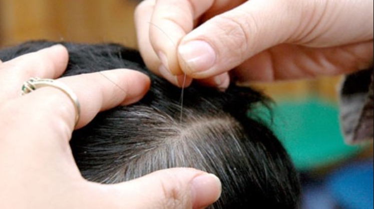 Vừng đen: "Thần dược" giúp tóc bạc hóa đen hay chỉ là lời đồn?- Ảnh 3.