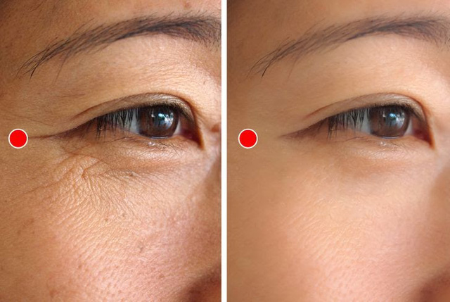 Bóc trần 4 lầm tưởng về chống lão hóa, tiết lộ 2 bí quyết thực sự ngăn ngừa nếp nhăn ít người biết- Ảnh 3. Bóc trần 4 lầm tưởng về chống lão hóa, tiết lộ 2 bí quyết thực sự ngăn ngừa nếp nhăn ít người biết- Ảnh 3.