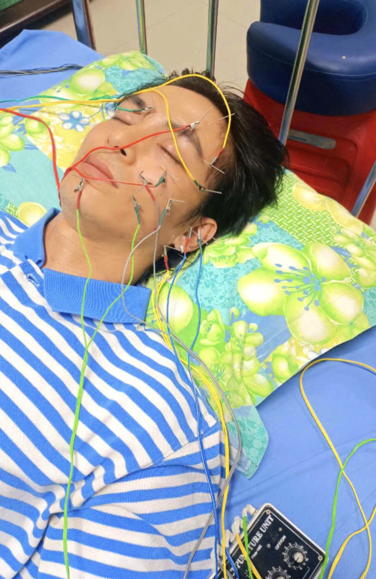 Nam diễn viên Lãnh Thanh bị liệt dây thần kinh số 7: Cảnh báo 3 thói quen gây bệnh mà giới trẻ thường mắc phải- Ảnh 1.