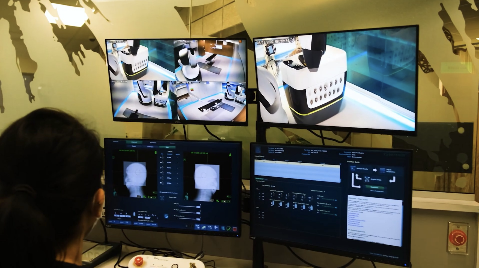 Thiết bị điều trị ung thư bằng Robot tích hợp AI có giá 200 tỷ, giúp rút ngắn thời gian xạ trị xuống 1/2 buổi so với liệu pháp truyền thống- Ảnh 3. Thiết bị điều trị ung thư bằng Robot tích hợp AI có giá 200 tỷ, giúp rút ngắn thời gian xạ trị xuống 1/2 buổi so với liệu pháp truyền thống- Ảnh 3.