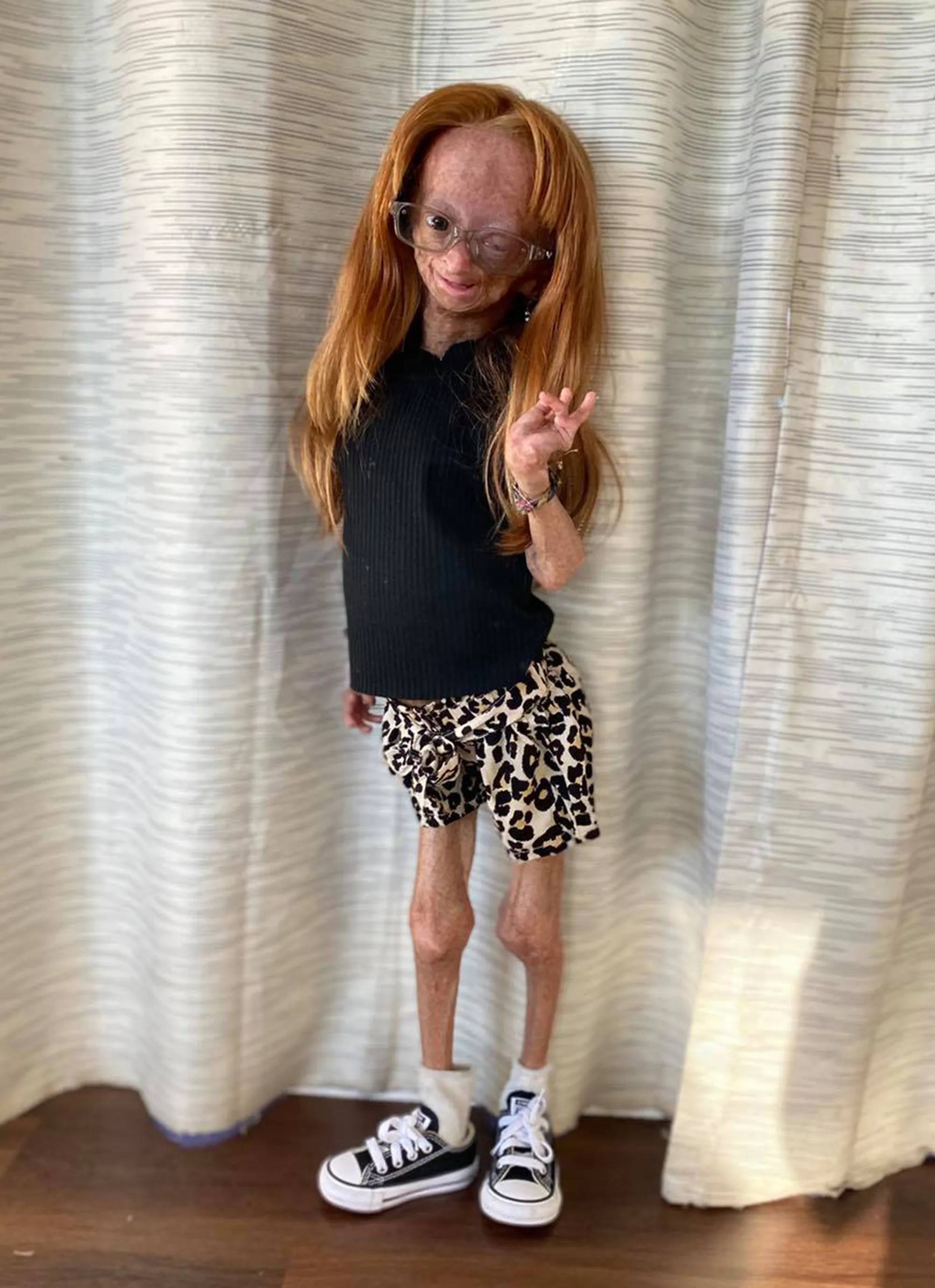 Những đứa trẻ có "tuổi thơ bị rút ngắn" và câu chuyện lão hóa ngay khi còn là trẻ con - Ảnh 2.