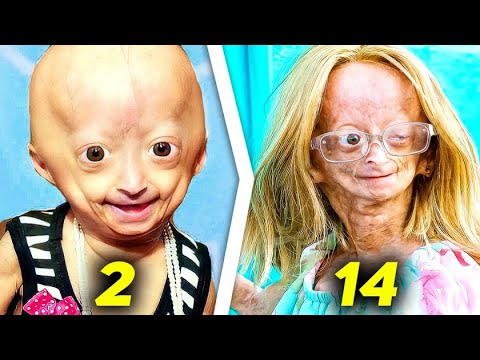 Những đứa trẻ có "tuổi thơ bị rút ngắn" và câu chuyện lão hóa ngay khi còn là trẻ con - Ảnh 4.