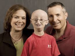 Những đứa trẻ có "tuổi thơ bị rút ngắn" và câu chuyện lão hóa ngay khi còn là trẻ con - Ảnh 5.