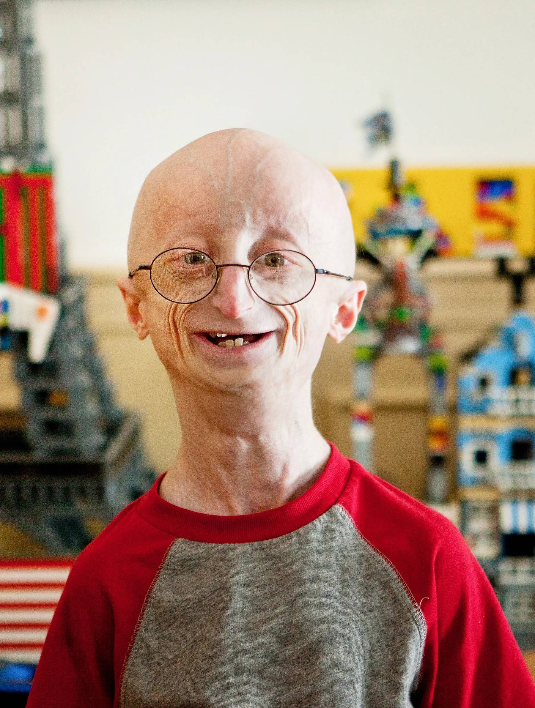 Những đứa trẻ có "tuổi thơ bị rút ngắn" và câu chuyện lão hóa ngay khi còn là trẻ con - Ảnh 6.