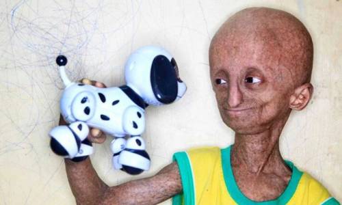 Những đứa trẻ có "tuổi thơ bị rút ngắn" và câu chuyện lão hóa ngay khi còn là trẻ con - Ảnh 8.