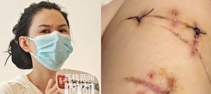 Cô gái bị đâm 22 nhát dao thoát chết nhờ từng nâng cấp vòng 1