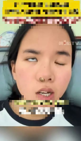 Người phụ nữ 25 tuổi bị liệt mặt sau giấc ngủ trưa, bác sĩ đưa ra cảnh báo- Ảnh 2.