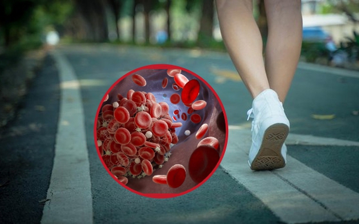 Trước khi một căn bệnh nghiêm trọng ập đến, bạn có thể nhận ra thay đổi khi đi bộ: Nếu có 4 triệu chứng này thì hãy đi khám ngay- Ảnh 2. Trước khi một căn bệnh nghiêm trọng ập đến, bạn có thể nhận ra thay đổi khi đi bộ: Nếu có 4 triệu chứng này thì hãy đi khám ngay- Ảnh 2.