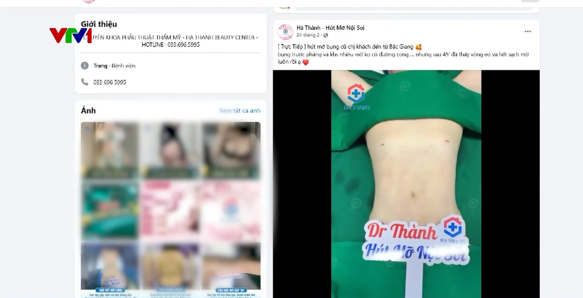 Hà Nội: Phát hiện cơ sở thẩm mỹ trái phép hút mỡ cho hàng trăm người - Ảnh 4.