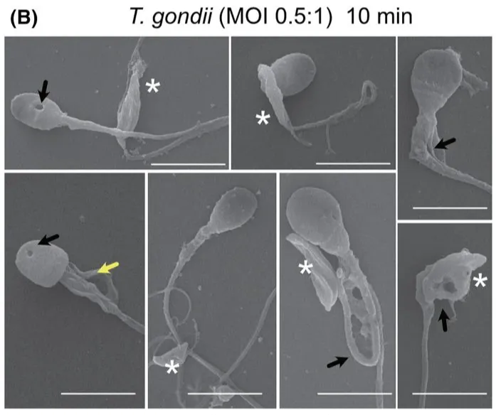 Loại ký sinh trùng lây nhiễm cho gần một nửa dân số thế giới, có thể khiến tinh trùng của con người gặp chuyện này- Ảnh 2.