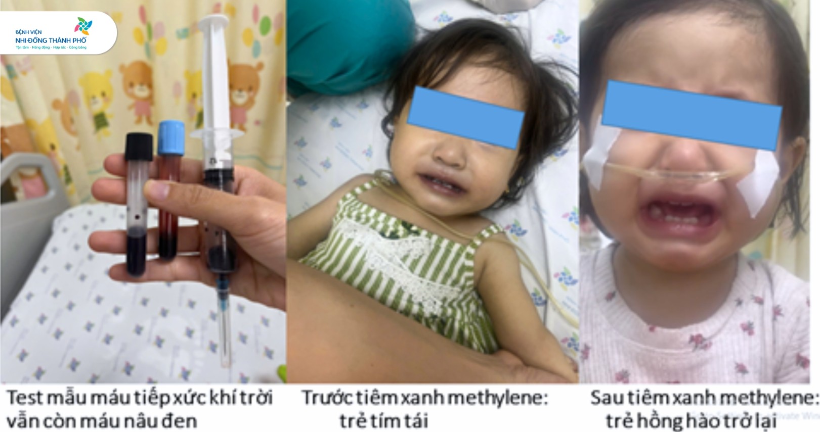 1 giờ sau khi ăn canh nấu bằng nước giếng, bé gái tím tái toàn thân, máu chuyển thành màu đen