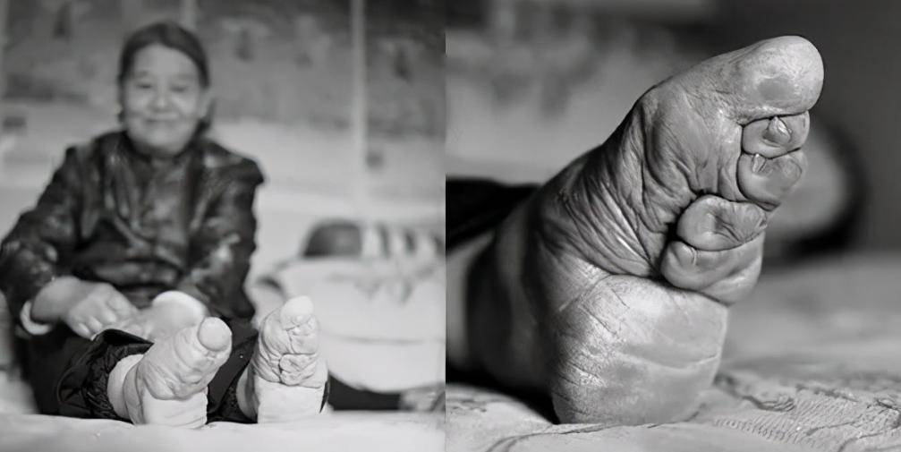 Cô gái 15 tuổi lấy chồng giàu nhờ "gót sen ba tấc" nhưng cái giá phải trả là thanh xuân bị bóp nghẹt đau đớn- Ảnh 2.