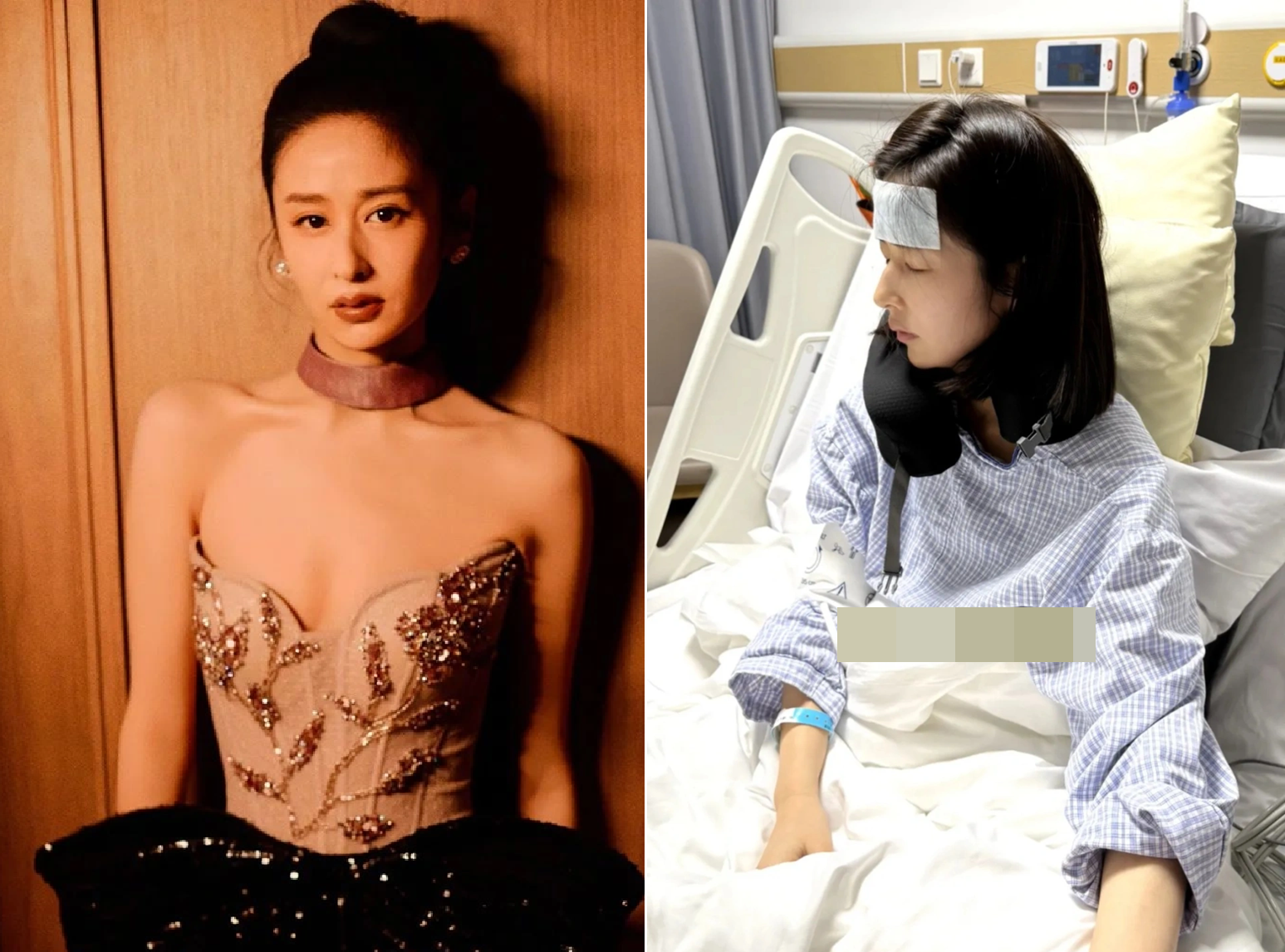 Một nữ diễn viên hạng A phải cắt bỏ túi mật vì sỏi mật, túi mật mất chức năng- Ảnh 1.