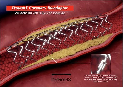 Công bố quan trọng tại EuroPCR 2025: Stent tương thích sinh học thế hệ mới giảm biến chứng tim mạch đáng kể so với stent phủ thuốc hiện đại- Ảnh 3.