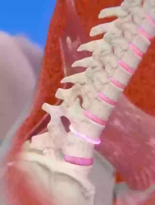 Cơn hắt hơi kinh hoàng khiến người phụ nữ bị liệt gần một năm: Câu chuyện gây ám ảnh trên mạng xã hội!- Ảnh 2. Cơn hắt hơi kinh hoàng khiến người phụ nữ bị liệt gần một năm: Câu chuyện gây ám ảnh trên mạng xã hội!- Ảnh 2.