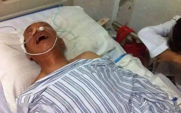 Ngày càng nhiều người tử vong vì nhồi máu não? Bác sĩ khuyên: Uống nước nóng còn hơn ăn 4 thứ này- Ảnh 1.