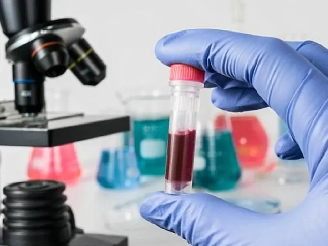 6 dấu hiệu cảnh báo bệnh nguy hiểm về máu, đừng chủ quan vì dễ nhầm với... 'bệnh vặt' - Ảnh 1.